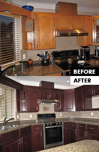 Refacing Before & After 1 Refacing Before & After 1
